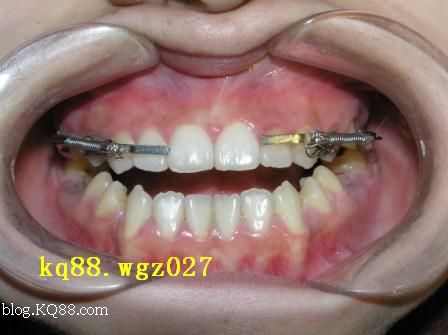 火狐电竞官方网站|玄彬-孙艺珍主演《爱的迫降》本周停播 将播出特辑(图1) 火狐电竞